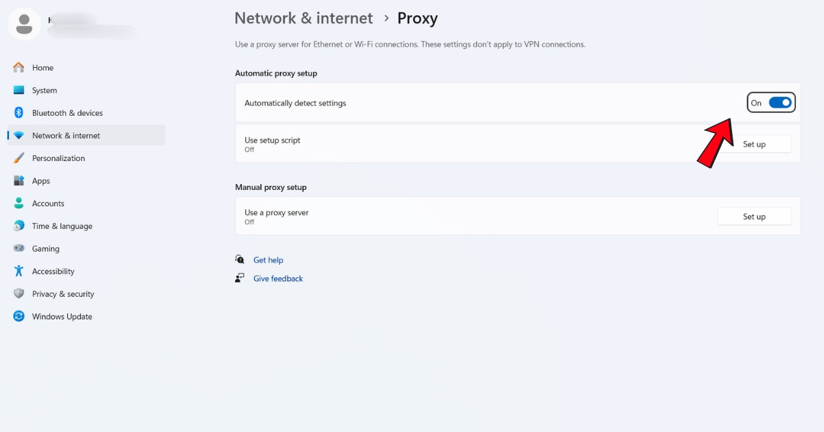Trang web không phản hồi: Nguyên nhân, cách khắc phục triệt để A-Z 63 Bạn tìm đến mục Automatically detect settings